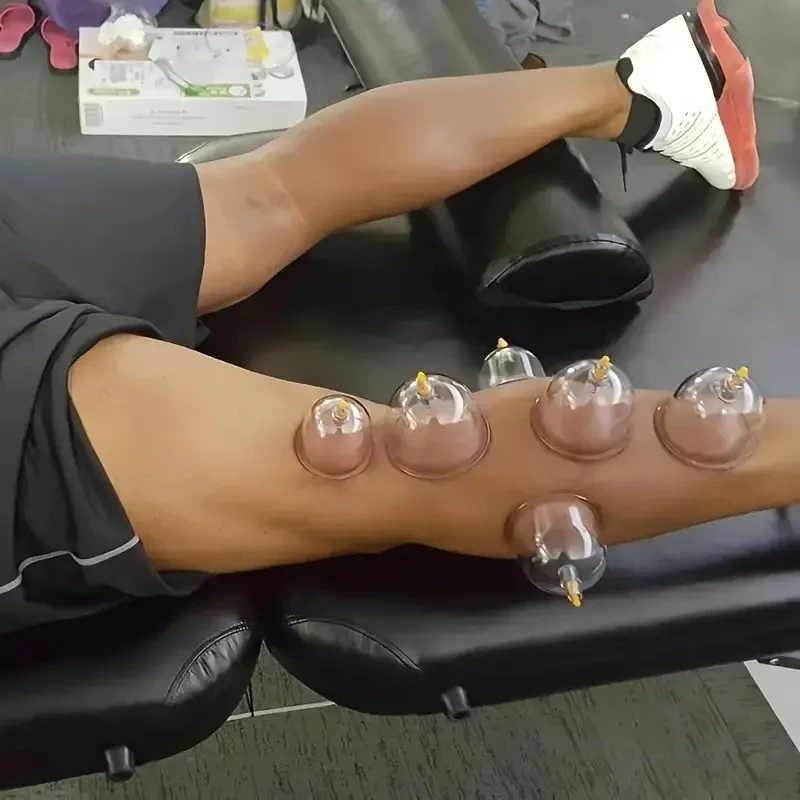 18pcs Suction Vacuum Cupping Set with 1 Manual Pump, Ideal for Back and Joint relief,Vacuum cupping body massager, Home Use Cupping cans for massage,  Therapy cupping Kit, Joint Relief cupping massage set - Image 3